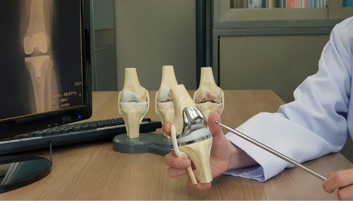 Knee Transplantation