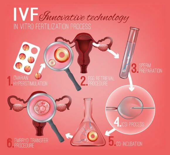 IVF Treatment Process