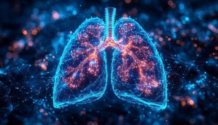 Treatment for Pleurisy